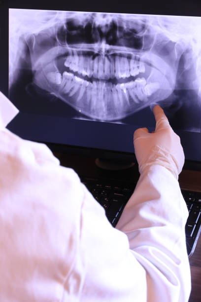 Best Broken or Cracked Tooth Emergency Dentist in China Lake Acres, CA
